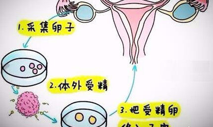 人工授精vs试管婴儿，有哪些不同之处？