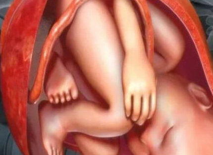 孕妈别喊怀孕辛苦了，其实胎宝在肚里保护妈妈，这些真相很暖心