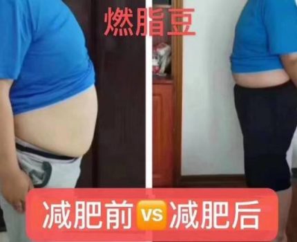 无限畅燃脂豆减肥需要忌口吗？减肥原理是什么？