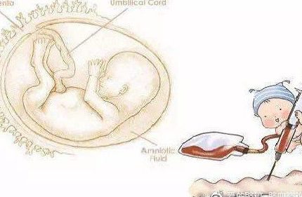怀孕不知道明显分娩信号，产前可就麻烦了