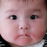 婴幼儿湿疹常见的8个误区，家长必须懂