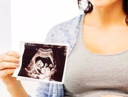孕晚期，别光傻等预产期，孕妇做好这3件事有助于分娩