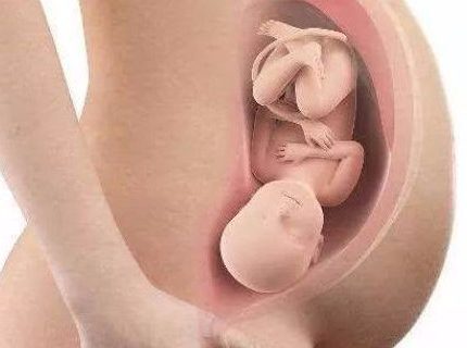 临产入盆时，为什么胎宝宝会将头乖乖朝下？